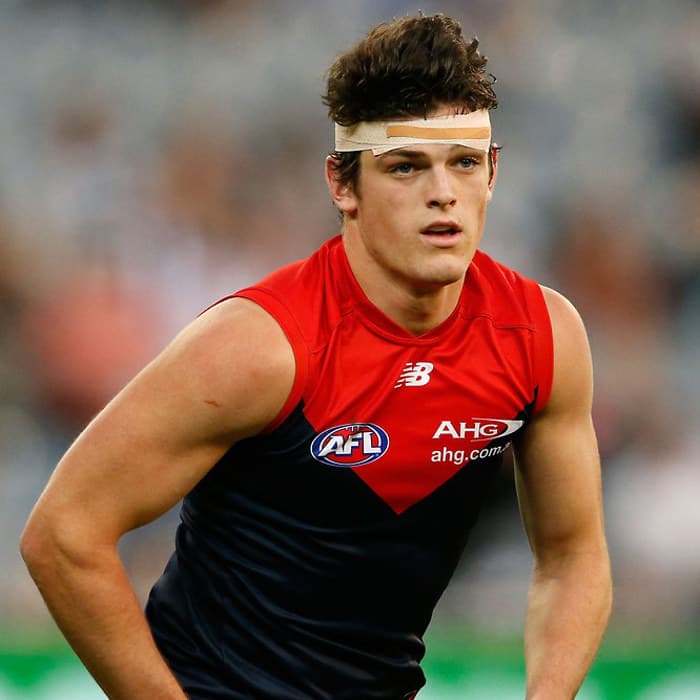 Angus Brayshaw